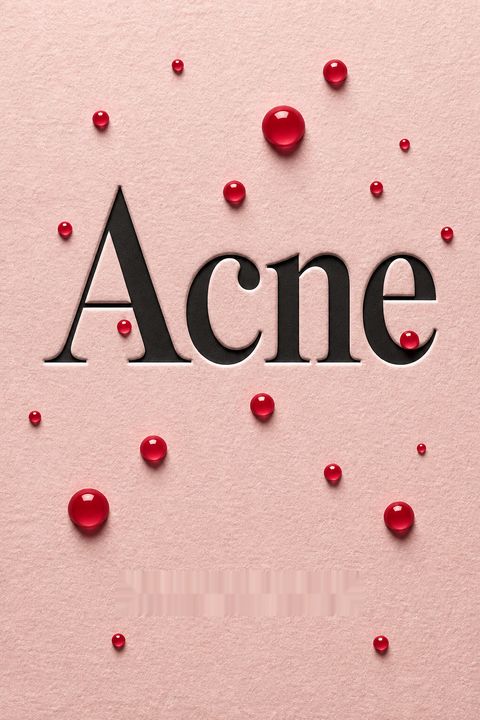 Acne by Laura Chinn