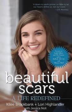 Beautiful Scars by Kilee Brookbank